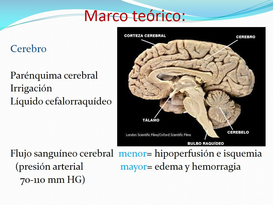 Fractura de la Bveda Craneal y Trauma Craneoenceflico